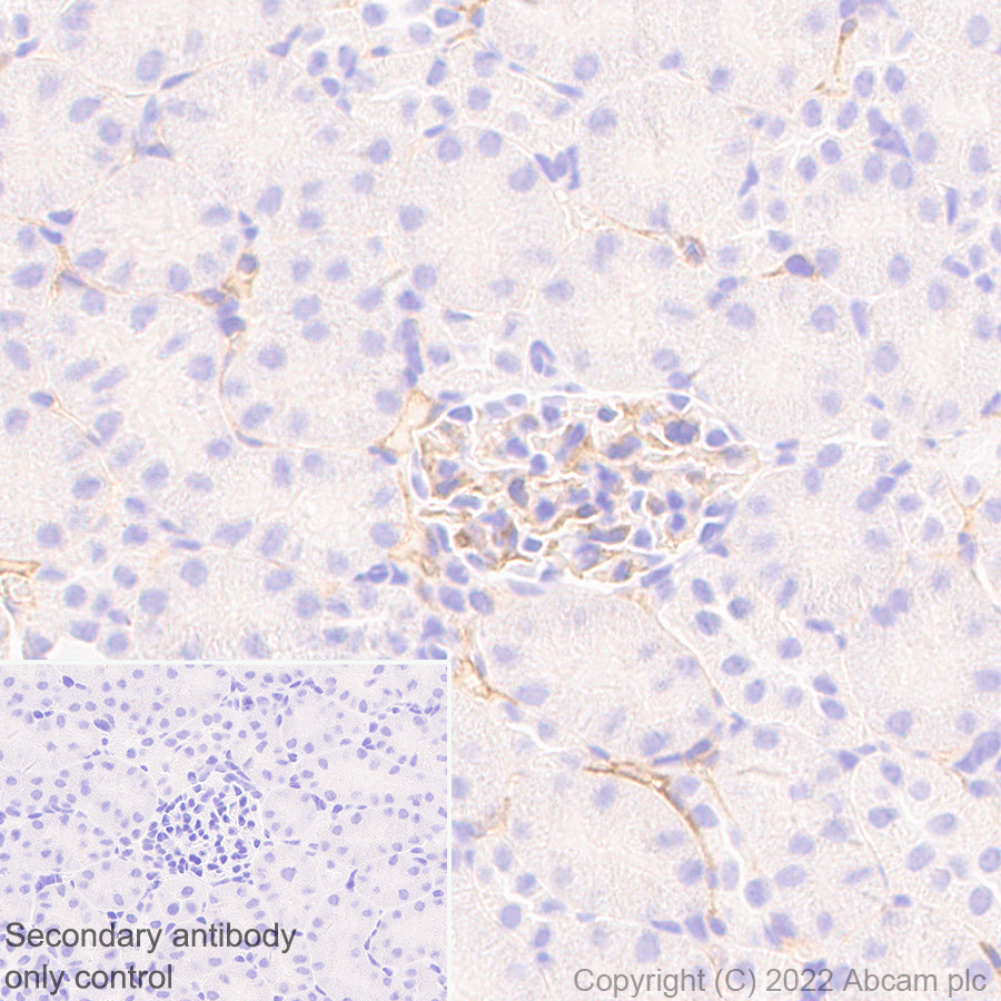 Immunohistochemistry - Anti-uPA Receptor/U-PAR antibody [EPR26916-73] - BSA and Azide free (ab307896), expandable thumbnail