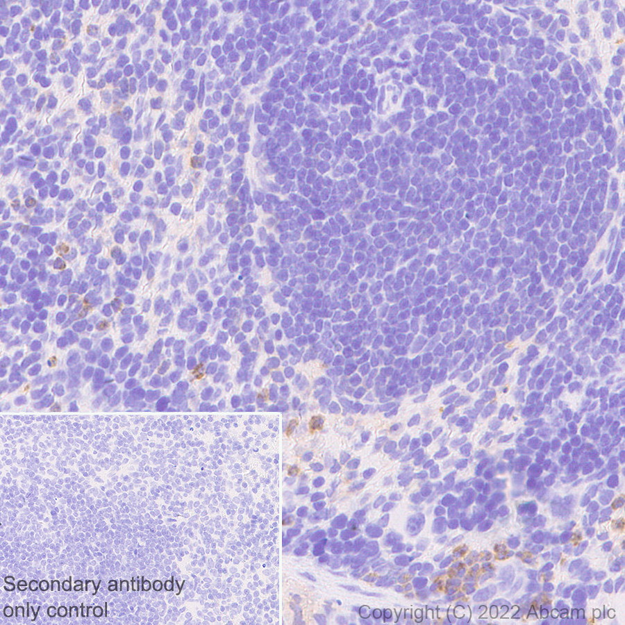 Immunohistochemistry - Anti-uPA Receptor/U-PAR antibody [EPR26916-73] - BSA and Azide free (AB307896), expandable thumbnail