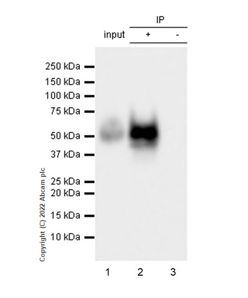 Immunoprecipitation - Anti-uPA Receptor/U-PAR antibody [EPR26916-73] - BSA and Azide free (ab307896), expandable thumbnail