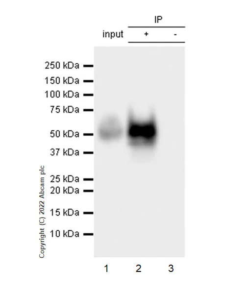 Immunoprecipitation - Anti-uPA Receptor/U-PAR antibody [EPR26916-73] - BSA and Azide free (AB307896)
