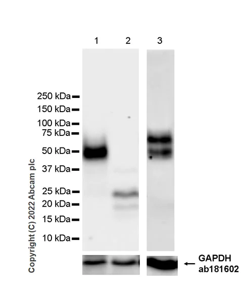 Western blot - Anti-uPA Receptor/U-PAR antibody [EPR26916-73] - BSA and Azide free (AB307896)