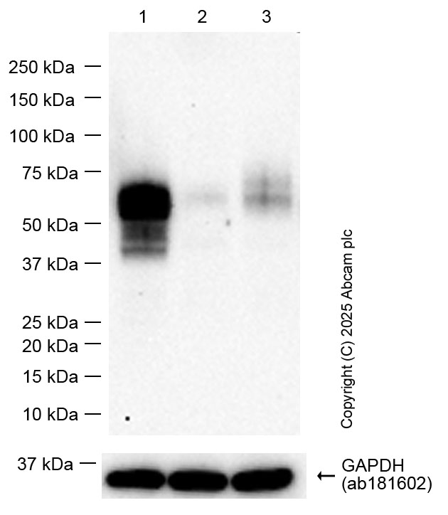 Western blot - Anti-uPA Receptor/U-PAR antibody [EPR26916-73] - BSA and Azide free (AB307896), expandable thumbnail