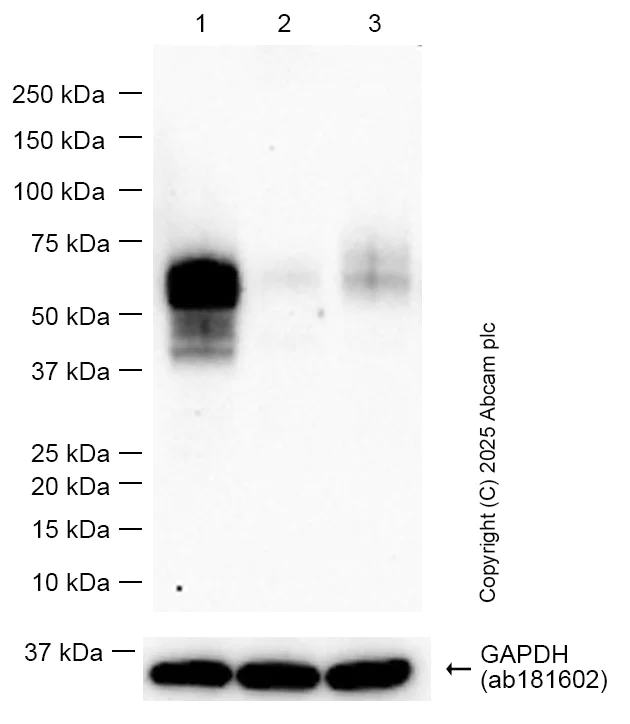 Western blot - Anti-uPA Receptor/U-PAR antibody [EPR26916-73] - BSA and Azide free (AB307896)