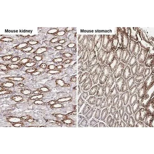 Immunohistochemistry (Formalin/PFA-fixed paraffin-embedded sections) - Anti-uPAR antibody [HL2169] (AB317150)