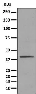 Western blot - Anti-UPB1 antibody [EPR9132] (AB157195)