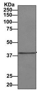 Immunoprecipitation - Anti-UPB1 antibody [EPR9132] - BSA and Azide free (AB249303)