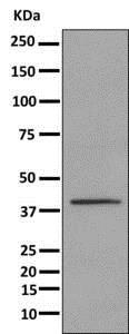 Western blot - Anti-UPB1 antibody [EPR9132] - BSA and Azide free (AB249303)