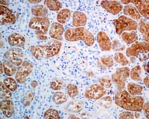 Immunohistochemistry (Formalin/PFA-fixed paraffin-embedded sections) - Anti-UPB1 antibody [EPR9133(B)] (AB140622)