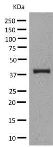 Western blot - Anti-UPB1 antibody [EPR9133(B)] - BSA and Azide free (AB248909)