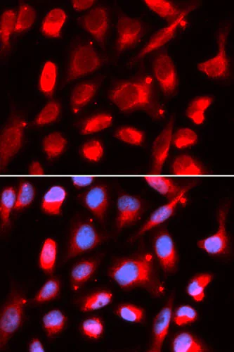 Immunocytochemistry/ Immunofluorescence - Anti-UPD antibody (AB196562)