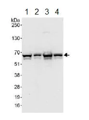 Western blot - Anti-UPF3B/RENT3B antibody (AB134566)