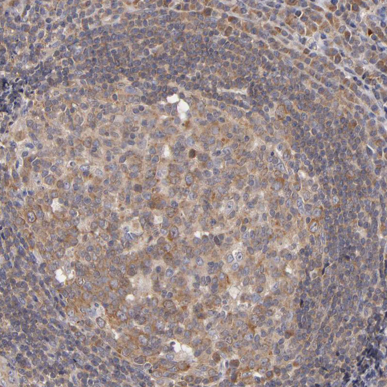 Immunohistochemistry (Formalin/PFA-fixed paraffin-embedded sections) - Anti-UPF3B/RENT3B antibody (AB251661)