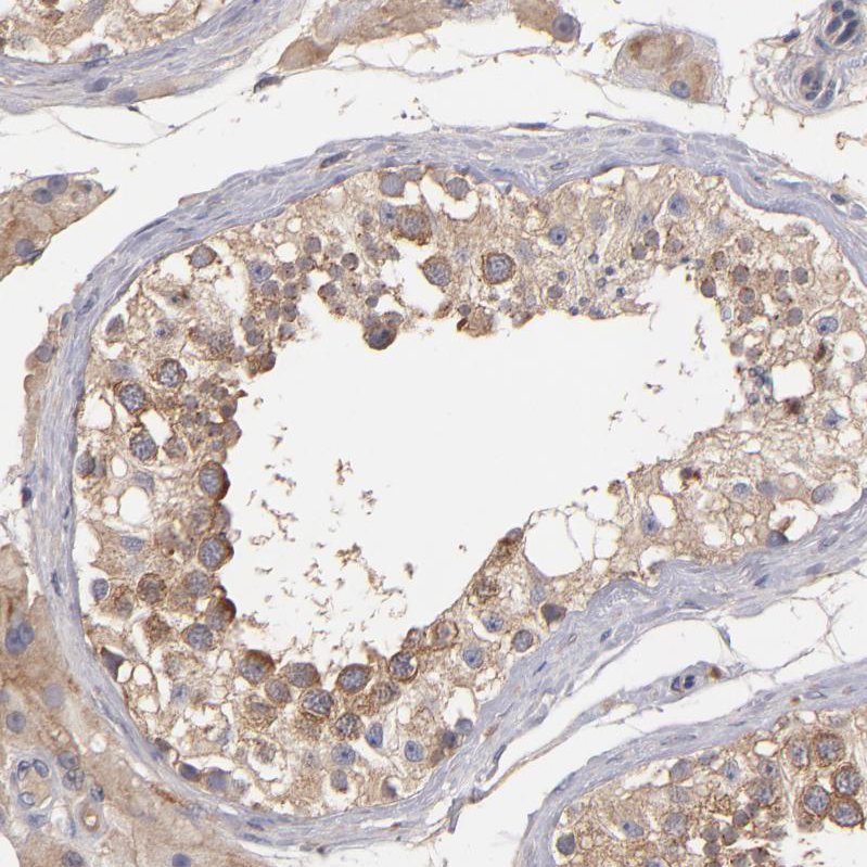 Immunohistochemistry (Formalin/PFA-fixed paraffin-embedded sections) - Anti-UPF3B/RENT3B antibody (AB251661)