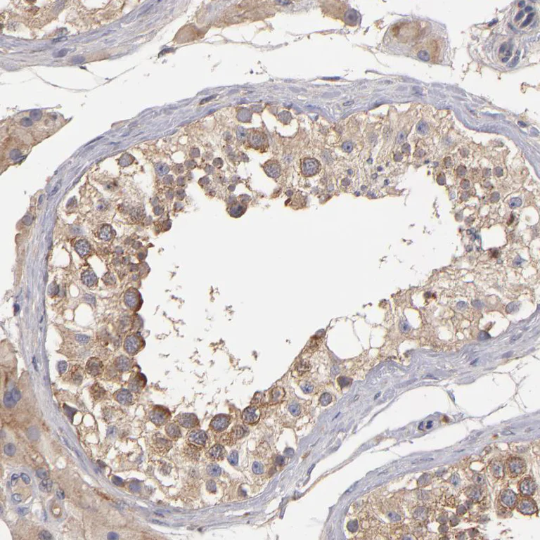 Immunohistochemistry (Formalin/PFA-fixed paraffin-embedded sections) - Anti-UPF3B/RENT3B antibody (AB251661)