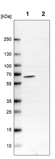 Western blot - Anti-UPF3B/RENT3B antibody (AB251661)