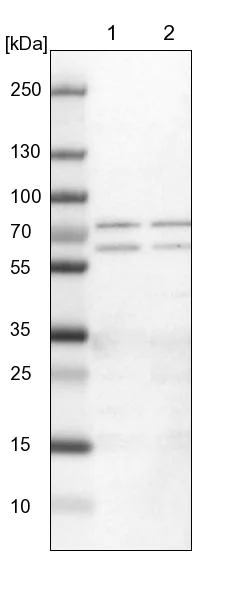 Western blot - Anti-UPF3B/RENT3B antibody (AB251661)