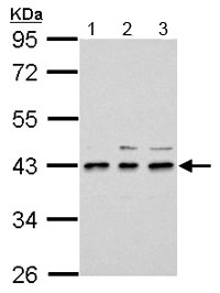 Western blot - Anti-UPP2 antibody (AB153861), expandable thumbnail