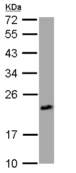 Western blot - Anti-UPRT antibody (AB111701)
