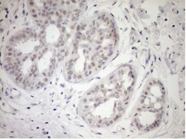 Immunohistochemistry (Formalin/PFA-fixed paraffin-embedded sections) - Anti-Upstream Binding Protein 1 antibody [OTI9G7] (AB279379)