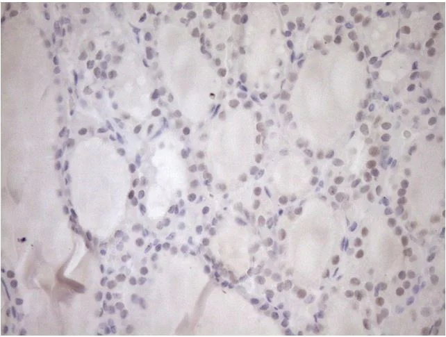Immunohistochemistry (Formalin/PFA-fixed paraffin-embedded sections) - Anti-Upstream Binding Protein 1 antibody [OTI9G7] (AB279379)