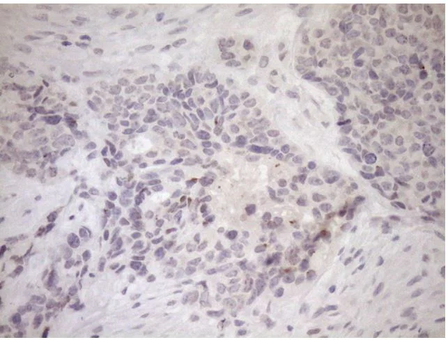Immunohistochemistry (Formalin/PFA-fixed paraffin-embedded sections) - Anti-Upstream Binding Protein 1 antibody [OTI9G7] (AB279379)