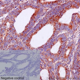 Anti-UQCRB antibody [EPR15591]