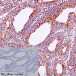 Immunohistochemistry (Formalin/PFA-fixed paraffin-embedded sections) - Anti-UQCRB antibody [EPR15591] (AB190360)