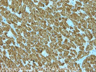 Immunohistochemistry (Formalin/PFA-fixed paraffin-embedded sections) - Anti-UQCRC2 antibody [13G12AF12BB11] (AB14745), expandable thumbnail