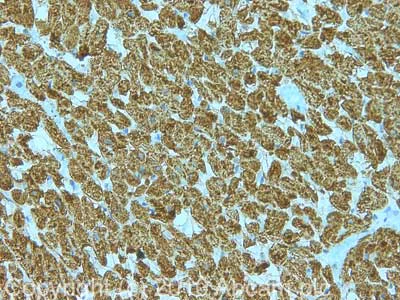 Immunohistochemistry (Formalin/PFA-fixed paraffin-embedded sections) - Anti-UQCRC2 antibody [13G12AF12BB11] (AB14745)