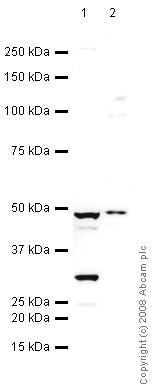 Western blot - Anti-UQCRC2 antibody [13G12AF12BB11] (AB14745), expandable thumbnail