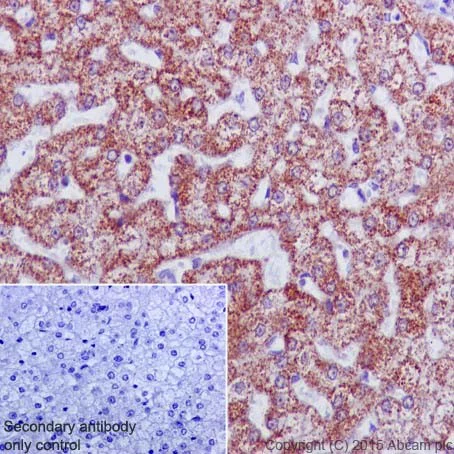Immunohistochemistry (Formalin/PFA-fixed paraffin-embedded sections) - Anti-UQCRC2 antibody [EPR13051] (AB203832)