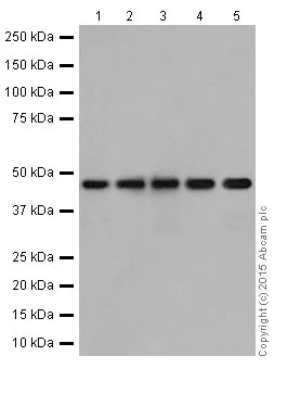 Western blot - Anti-UQCRC2 antibody [EPR13051] (AB203832)