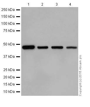 Western blot - Anti-UQCRC2 antibody [EPR13051] (AB203832)