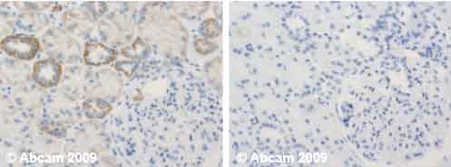 Immunohistochemistry (Formalin/PFA-fixed paraffin-embedded sections) - Anti-UQCRFS1/RISP antibody [5A5] (AB14746), expandable thumbnail