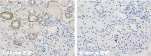 Immunohistochemistry (Formalin/PFA-fixed paraffin-embedded sections) - Anti-UQCRFS1/RISP antibody [5A5] (AB14746)