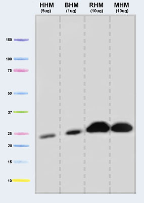 Western blot - Anti-UQCRFS1/RISP antibody [5A5] (AB14746), expandable thumbnail
