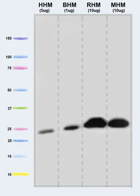 Western blot - Anti-UQCRFS1/RISP antibody [5A5] (AB14746)