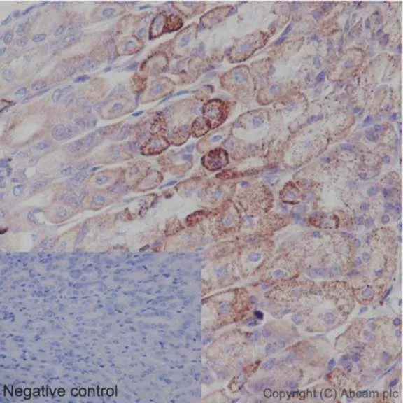 Immunohistochemistry (Formalin/PFA-fixed paraffin-embedded sections) - Anti-UQCRFS1/RISP antibody [EPR16288] (AB191078)