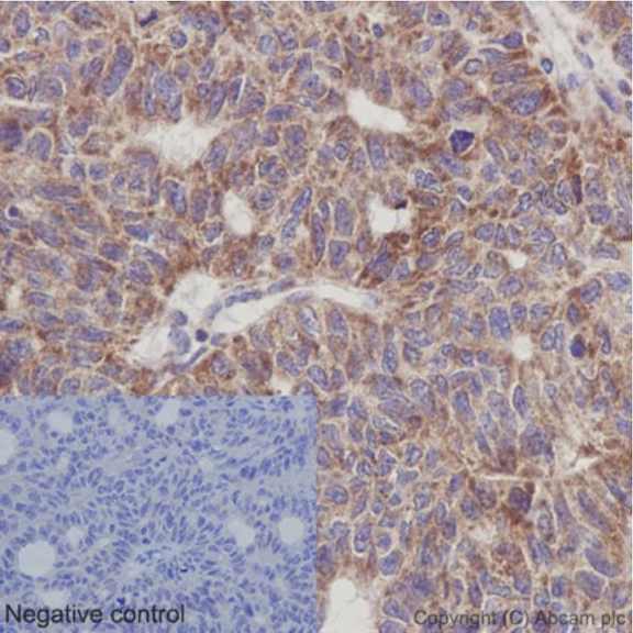 Immunohistochemistry (Formalin/PFA-fixed paraffin-embedded sections) - Anti-UQCRFS1/RISP antibody [EPR16288] (AB191078)