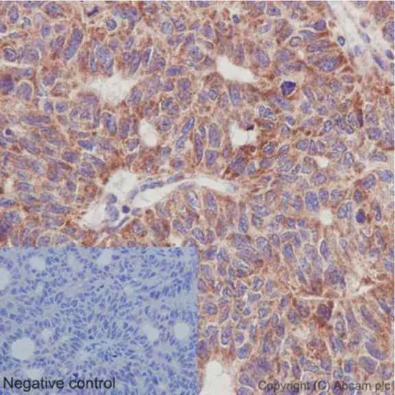 Immunohistochemistry (Formalin/PFA-fixed paraffin-embedded sections) - Anti-UQCRFS1/RISP antibody [EPR16288] (AB191078)
