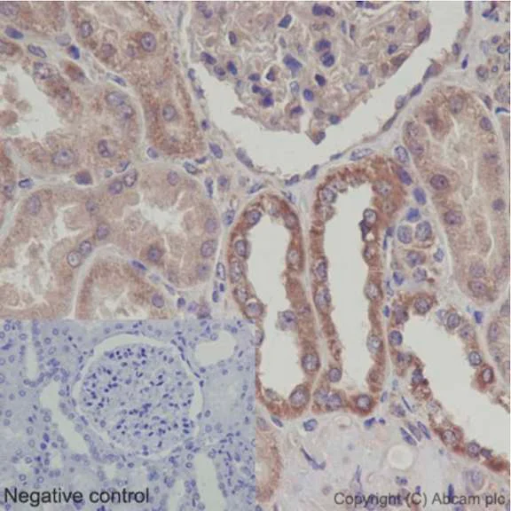 Immunohistochemistry (Formalin/PFA-fixed paraffin-embedded sections) - Anti-UQCRFS1/RISP antibody [EPR16288] - BSA and Azide free (AB251053)