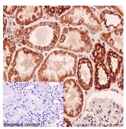 Immunohistochemistry (Formalin/PFA-fixed paraffin-embedded sections) - Anti-UQCRFS1/RISP antibody [EPR16289] - BSA and Azide free (AB251054)