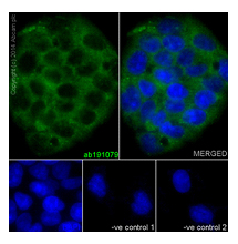 Immunocytochemistry/ Immunofluorescence - Anti-UQCRFS1/RISP antibody [EPR16289] - C-terminal (AB191079)