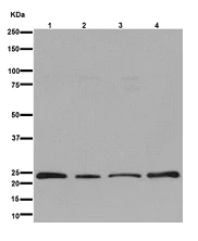 Western blot - Anti-UQCRFS1/RISP antibody [EPR16289] - C-terminal (AB191079)