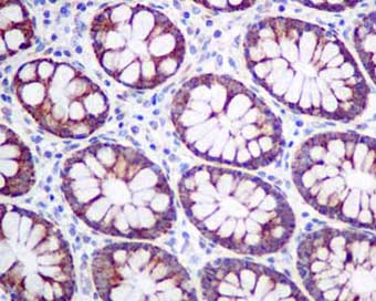Immunohistochemistry (Formalin/PFA-fixed paraffin-embedded sections) - Anti-UQCRH antibody [EPR9038(B)] (AB154803), expandable thumbnail