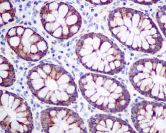 Immunohistochemistry (Formalin/PFA-fixed paraffin-embedded sections) - Anti-UQCRH antibody [EPR9038(B)] (AB154803)