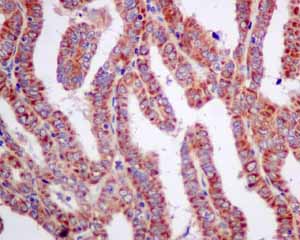 Immunohistochemistry (Formalin/PFA-fixed paraffin-embedded sections) - Anti-UQCRH antibody [EPR9038(B)] (ab154803), expandable thumbnail
