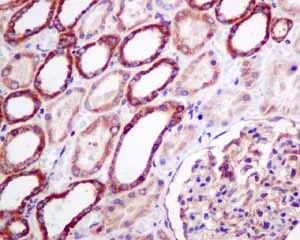 Immunohistochemistry (Formalin/PFA-fixed paraffin-embedded sections) - Anti-UQCRH antibody [EPR9038(B)] (AB154803)