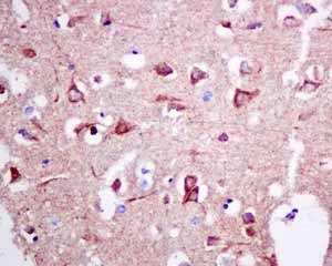 Immunohistochemistry (Formalin/PFA-fixed paraffin-embedded sections) - Anti-UQCRH antibody [EPR9038(B)] (AB154803), expandable thumbnail
