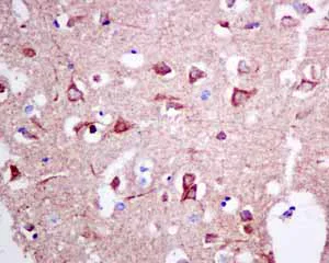 Immunohistochemistry (Formalin/PFA-fixed paraffin-embedded sections) - Anti-UQCRH antibody [EPR9038(B)] (AB154803)